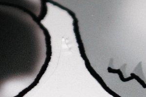 引っかかってビローン